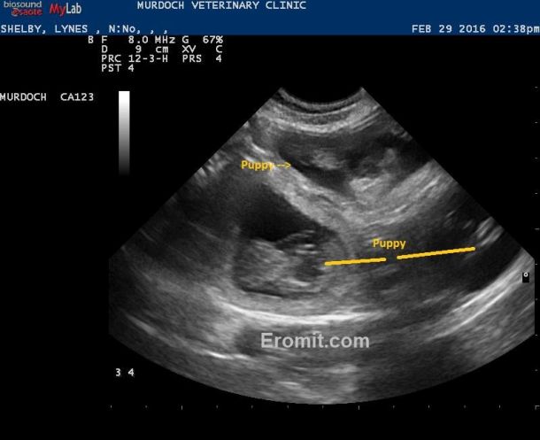 2-29-16 ultrasound w watermark