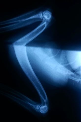 8-24-17 prelim elbows